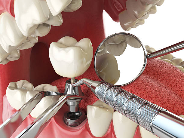 Best Broken or Cracked Tooth Emergency Dentist in Forestdale, MA